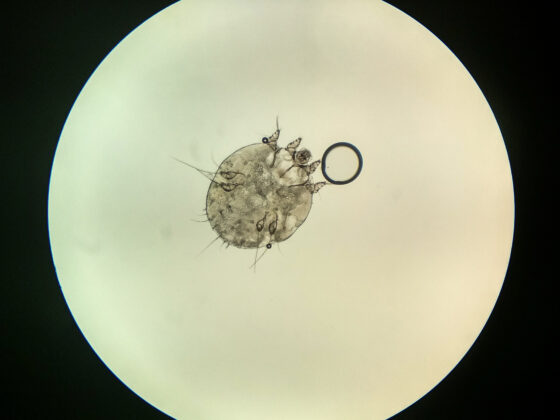 疥癬はどのくらいの期間罹ることがありますか?