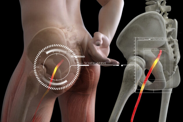 坐骨神経痛とは？痛みや痺れの症状と原因、やってはいけないことを解説