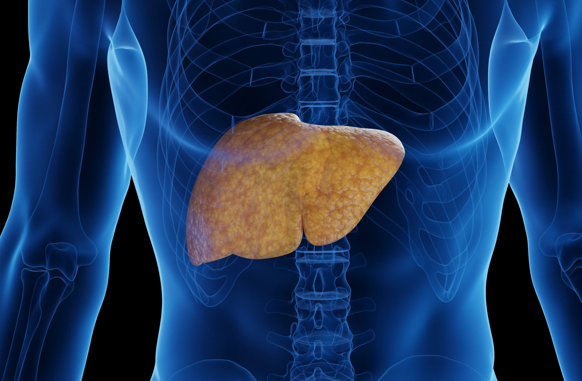 脂肪肝とは？肝臓に脂肪がたまる原因と症状、改善方法を解説