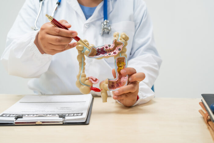 大腸ESD（内視鏡的粘膜下層剥離術）とは？入院期間・費用から、トラクションデバイスを用いた最新手技のメリットまで徹底解説