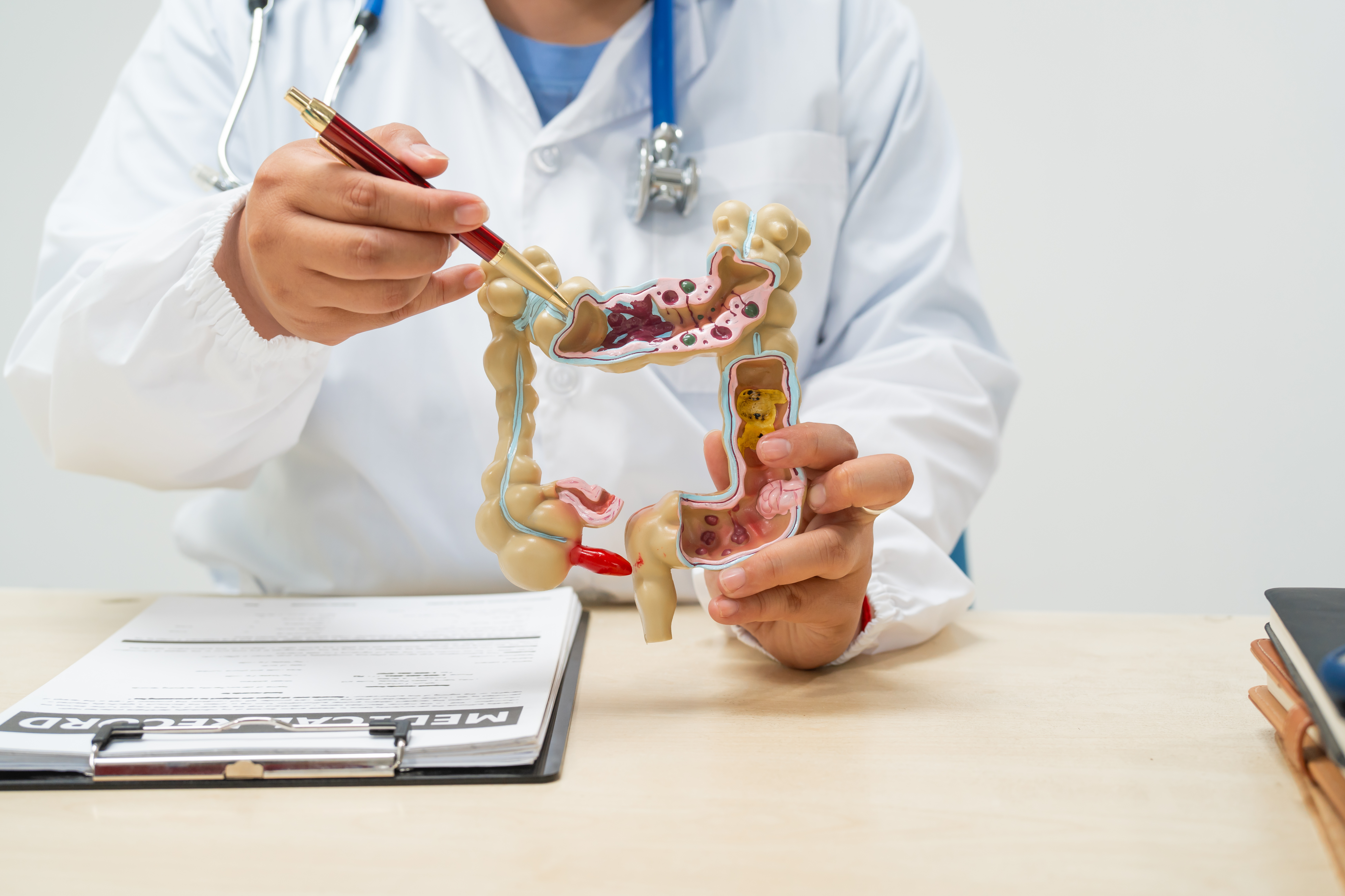 大腸ESD（内視鏡的粘膜下層剥離術）とは？入院期間・費用から、トラクションデバイスを用いた最新手技のメリットまで徹底解説