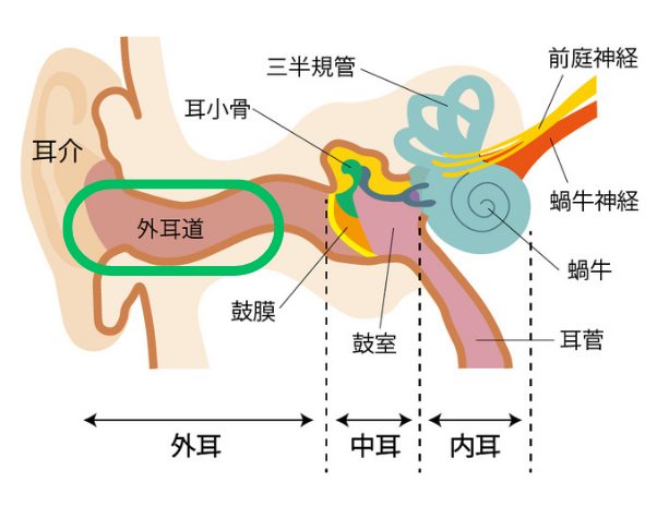 外耳道に起こる炎症｜外耳炎