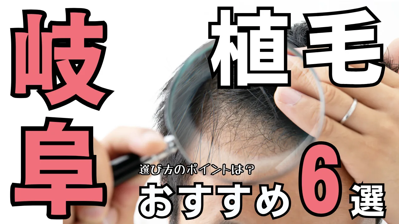 岐阜おすすめ植毛クリニック６選！後悔しない選び方を解説