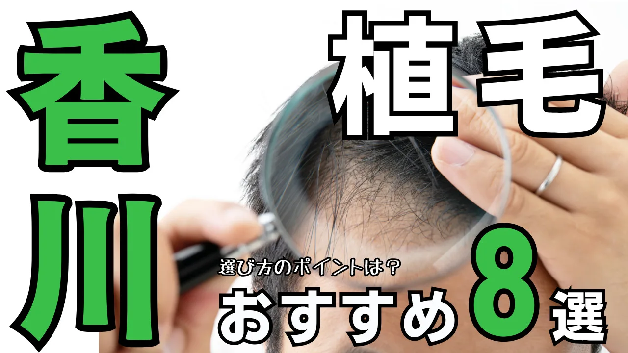 植毛【香川】おすすめクリニック８選！治療法と後悔しない選び方を解説