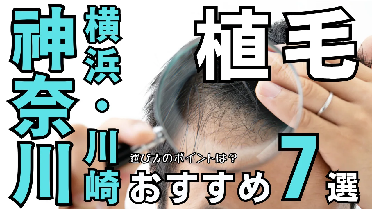 【横浜・川崎】自毛植毛クリニック７選！神奈川でおすすめの選び方を解説