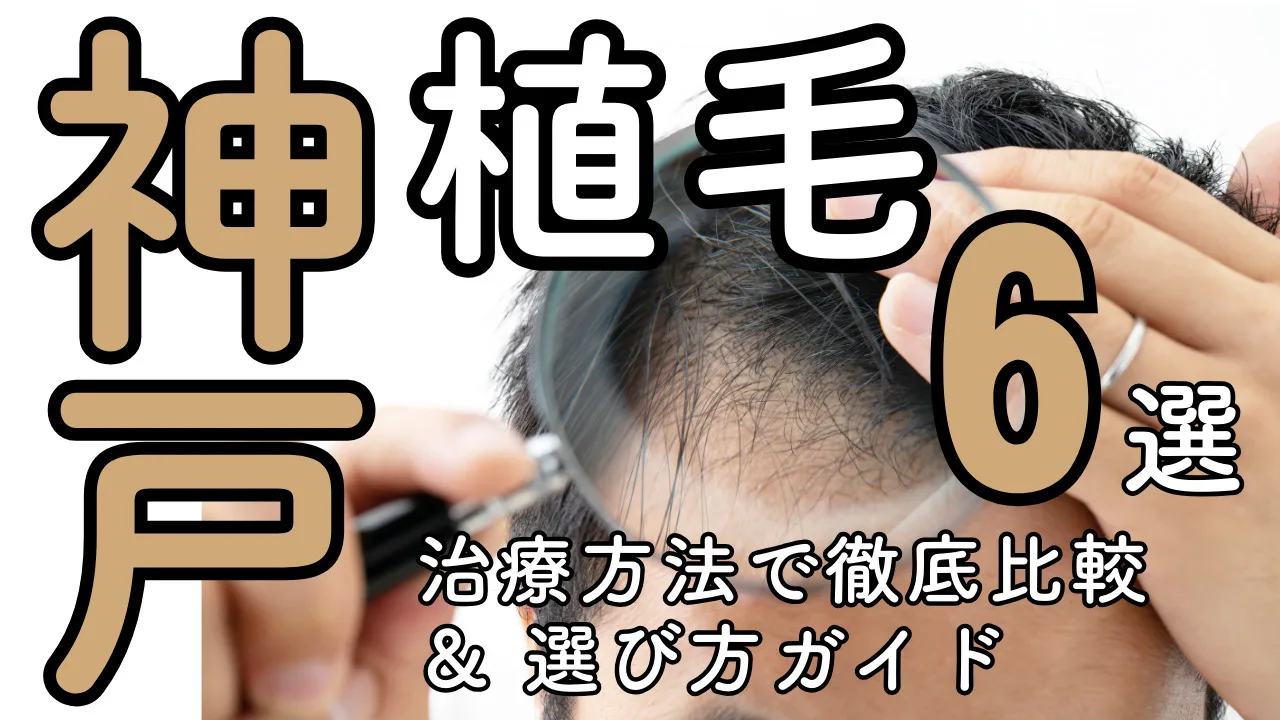 植毛【兵庫／神戸】おすすめクリニック６選！治療法と後悔しない選び方を解説