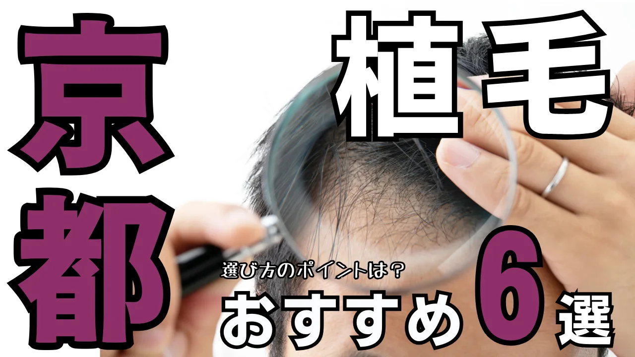 植毛【京都】おすすめクリニック６選！治療法と後悔しない選び方を解説