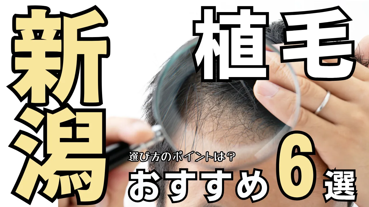新潟おすすめ植毛クリニック６選！後悔しない選び方を解説