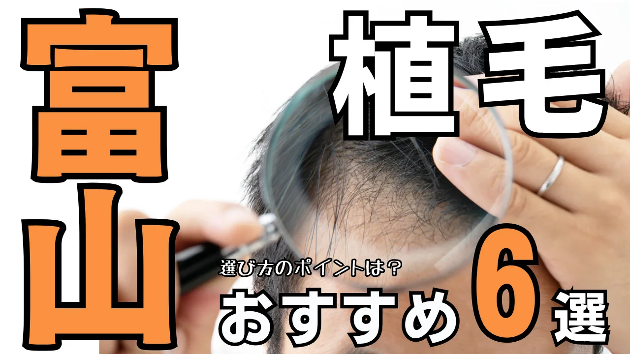 富山の方におすすめの植毛クリニック６選！後悔しない選び方を解説