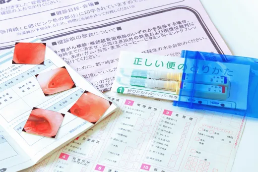 大腸がん検診：40代からの受診推奨と、 自治体・職域検診の賢い活用法