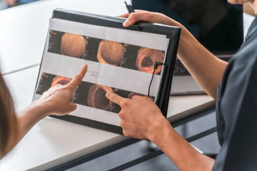 鎮静剤活用と経鼻内視鏡の実際