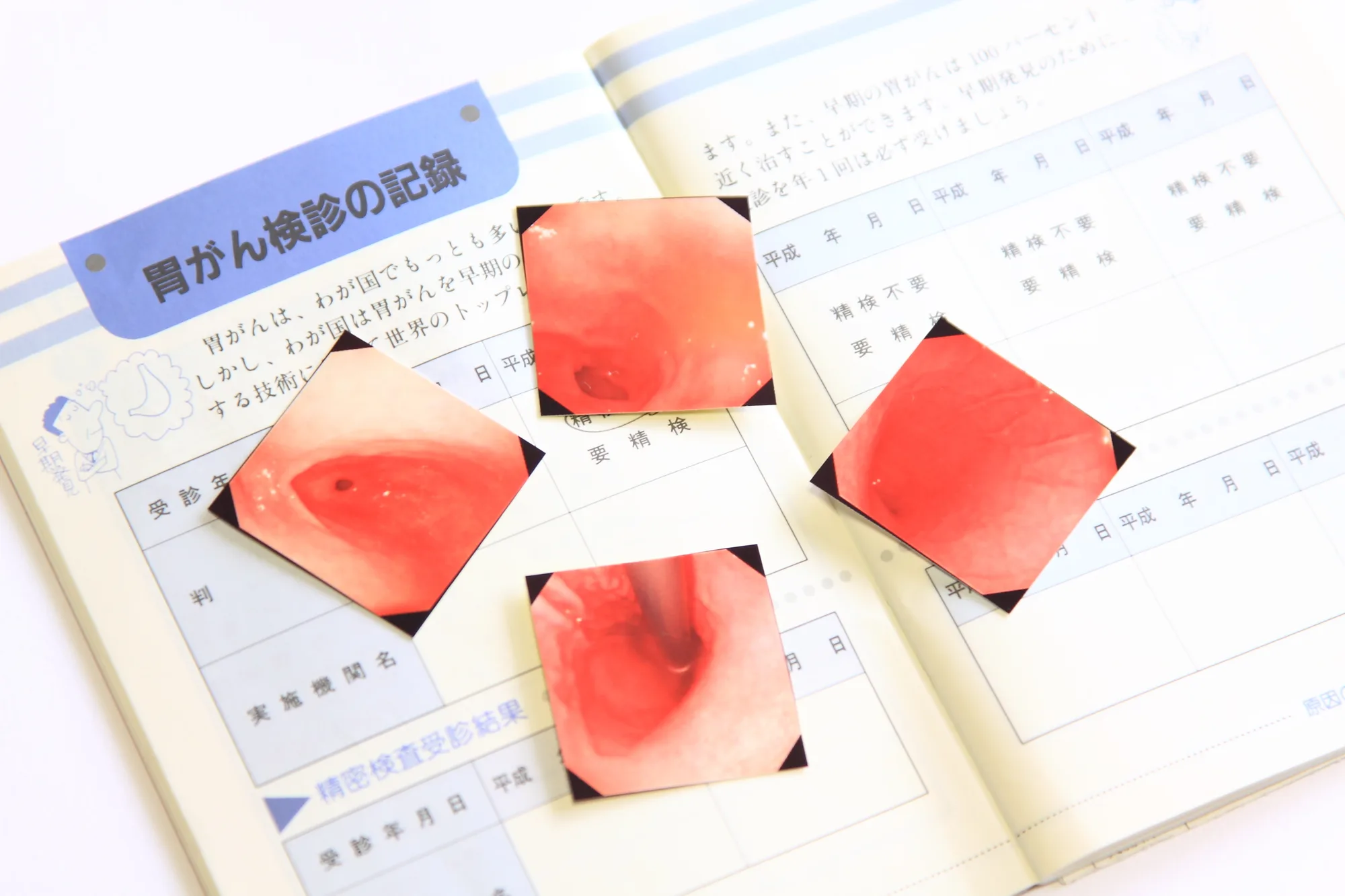 胃がん検診の全ガイド バリウム検査と胃カメラの違い、費用、受けるべき頻度を比較