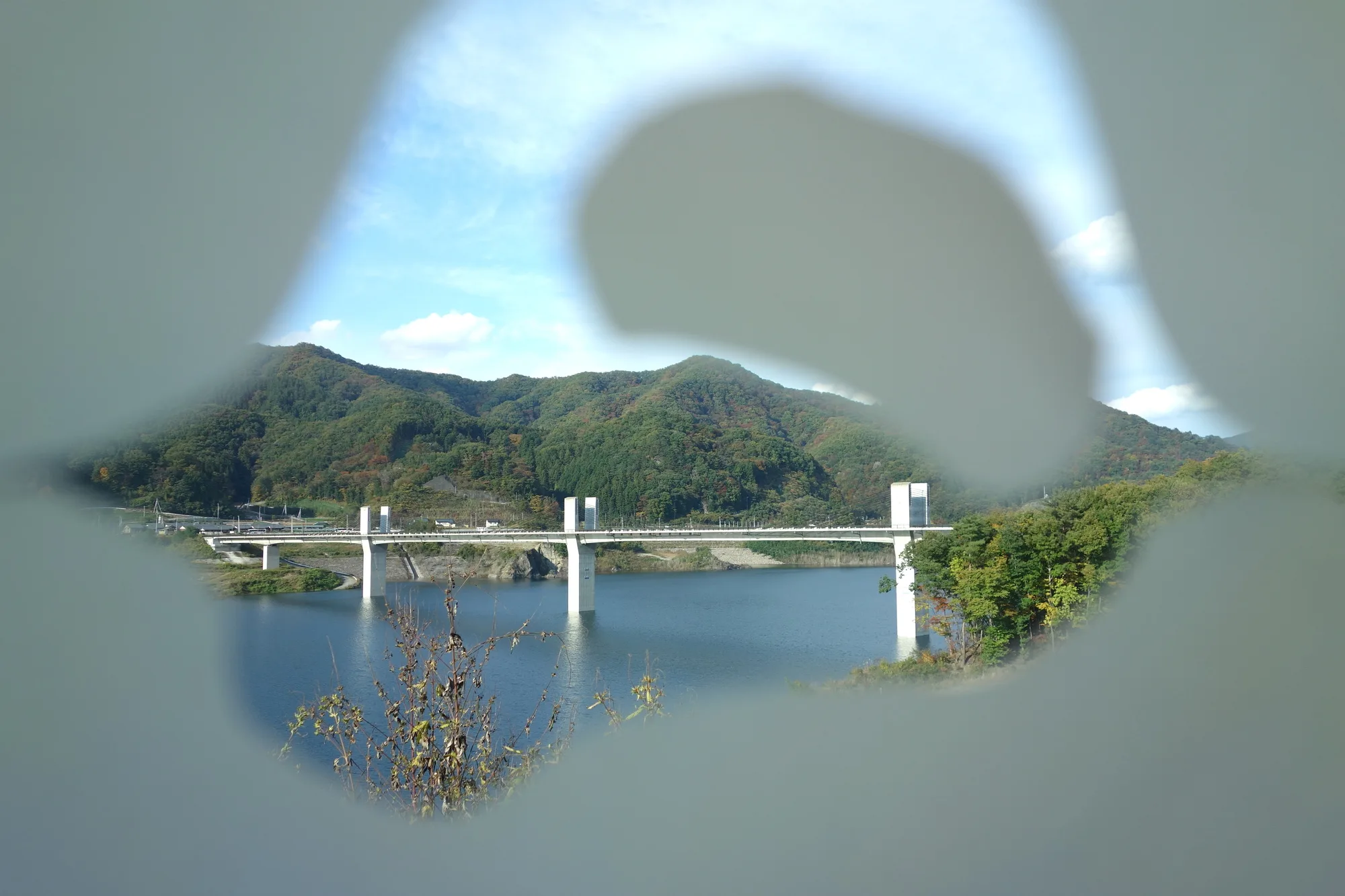 緑内障とは？原因・症状・治療法をわかりやすく解説