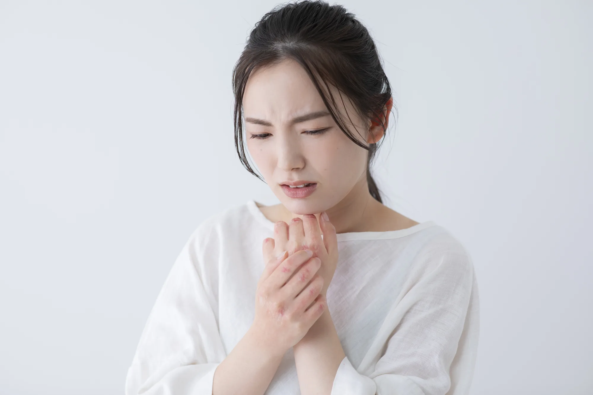 手湿疹の原因は？手荒れ（手の甲・手のひら）とストレスの関係を解説