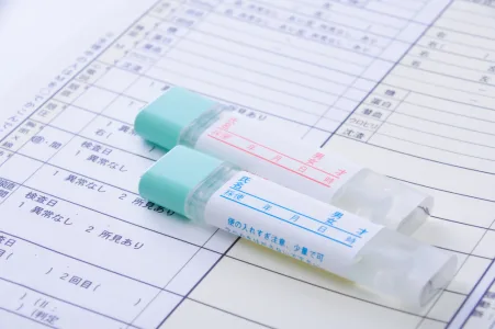 健康診断で、血便が見つかったら？ – 便潜血検査陽性